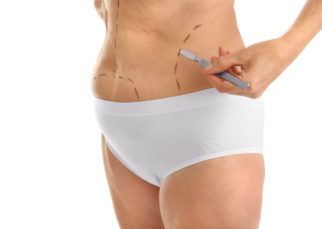 Vaser Liposuction Turkey – 6 Crucial Points